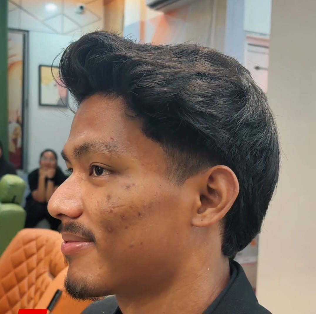 Before transformation 3